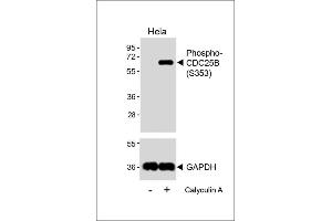 Western blot analysis of lysates from Hela cell line, untreated or treated with 20 % FBS + 100nM Calyculin A, 15 min, using Phospho-CDC25B Antibody (upper) or GDH(lower). (CDC25B 抗体  (pSer353))