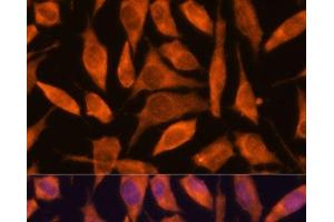 Immunofluorescence analysis of L929 cells using SCRN3 Polyclonal Antibody at dilution of 1:100. (Secernin 3 抗体)