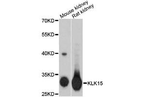 Western blot analysis of extracts of various cell lines, using KLK15 antibody (ABIN1873439) at 1:3000 dilution. (Kallikrein 15 抗体)