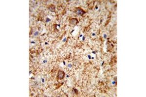 Formalin-fixed and paraffin-embedded human brain tissue reacted with Nociceptin  Antibody , which was peroxidase-conjugated to the secondary antibody, followed by DAB staining. (Nociceptin 抗体  (Middle Region))