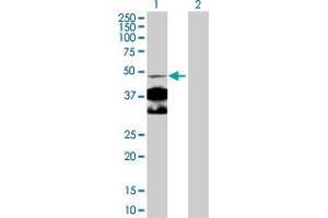 Western Blot analysis of NR4A1 expression in transfected 293T cell line by NR4A1 MaxPab polyclonal antibody. (NR4A1 抗体  (AA 1-598))