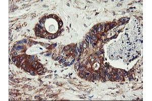 Image no. 1 for anti-Ubiquitin-Conjugating Enzyme E2, J1, U (UBE2J1) antibody (ABIN1501637) (UBE2J1 抗体)