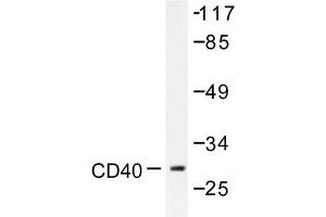 Image no. 1 for anti-CD40 (CD40) antibody (ABIN271944) (CD40 抗体)