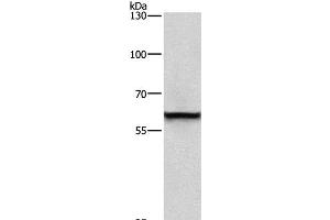 Western Blot analysis of A431 cell using TRIP4 Polyclonal Antibody at dilution of 1:400 (TRIP4 抗体)