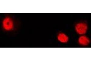 Immunofluorescent analysis of ATIC staining in U2OS cells. (ATIC 抗体)