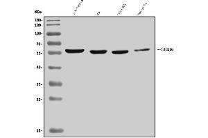 Western blot analysis of TRIM16 using anti-TRIM16 antibody (ABIN7602226).