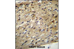ABCD2 Antibody (C-term) (ABIN656554 and ABIN2845816) immunohistochemistry analysis in formalin fixed and paraffin embedded human heart tissue followed by peroxidase conjugation of the secondary antibody and DAB staining. (CCL17 抗体  (C-Term))