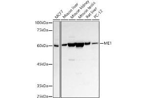 Western blot analysis of extracts of various cell lines, using ME1 antibody (ABIN1680809, ABIN3018339, ABIN3018340 and ABIN6220439) at 1:500 dilution. (ME1 抗体  (AA 1-300))