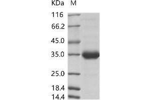Western Blotting (WB) image for Zika Virus Membrane (ZIKV M) protein (Fc Tag) (ABIN7198755) (ZIKV M Protein (Fc Tag))