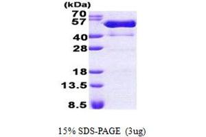SDS-PAGE (SDS) image for Proline-serine-threonine Phosphatase Interacting Protein 1 (PSTPIP1) (AA 1-416) protein (His tag) (ABIN5853033) (PSTPIP1 Protein (AA 1-416) (His tag))