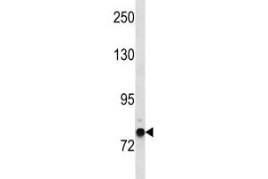 Western Blotting (WB) image for anti-Zinc Finger Protein 12 (ZNF12) antibody (ABIN3004528) (ZNF12 抗体)