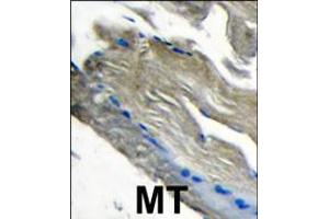 Formalin-fixed and paraffin-embedded human muscle tissue tissue reacted with PI3CKG antibody , which was peroxidase-conjugated to the secondary antibody, followed by DAB staining.