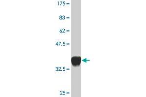 Western Blot detection against Immunogen (36. (PPOX 抗体  (AA 378-477))