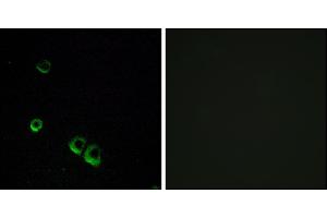 Immunofluorescence analysis of MCF-7 cells, using AVPR2 antibody. (AVPR2 抗体)
