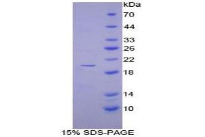SDS-PAGE analysis of Human DISC1 Protein. (DISC1 蛋白)
