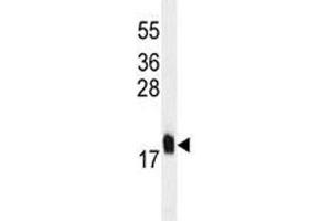 MCFD2 antibody western blot analysis in U251 lysate. (MCFD2 抗体)
