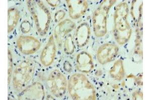Immunohistochemistry of paraffin-embedded human kidney tissue using ABIN7143737 at dilution of 1:100 (FUT6 抗体  (AA 170-359))