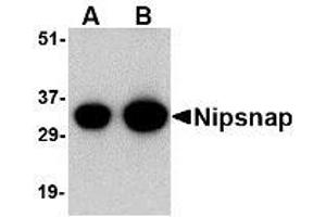 Image no. 1 for anti-4-Nitrophenylphosphatase Domain and Non-Neuronal SNAP25-Like Protein Homolog 1 (NIPSNAP1) (C-Term) antibody (ABIN1492169) (NIPSNAP1 抗体  (C-Term))