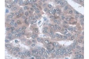 Immunohistochemistry (IHC) image for anti-Glutamic-Oxaloacetic Transaminase 1, Soluble (Aspartate Aminotransferase 1) (GOT1) (AA 1-413) antibody (ABIN7426220)