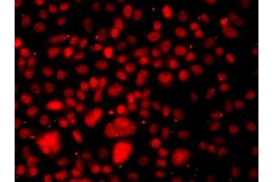Immunofluorescence analysis of A549 cells using RELA antibody. (NF-kB p65 抗体)