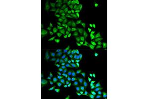 Immunofluorescence (IF) image for anti-GDP Dissociation Inhibitor 1 (GDI1) antibody (ABIN1876650) (GDI1 抗体)