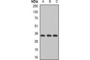 Western blot analysis of TAMM41 expression in MCF7 (A), K562 (B), Jurkat (C) whole cell lysates. (TAM41 抗体)