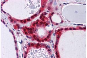 Human Thyroid: Formalin-Fixed, Paraffin-Embedded (FFPE) (PCBP2 抗体  (AA 1-363))