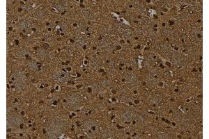 ABIN6267090 at 1/100 staining Rat brain tissue by IHC-P.