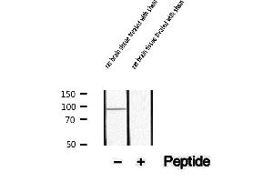 Western blot analysis of extracts of rat brain tissue treated with sham, using Phospho-PSD95 (Tyr236/Tyr240) Antibody.