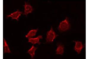 ABIN6272358 staining MCF7 by IF/ICC. (NEURL 抗体  (Internal Region))