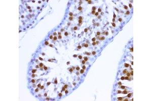 IHC-P: MCAK antibody testing of rat testis tissue (KIF2C 抗体  (AA 531-725))