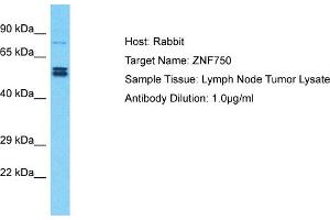 Host: Rabbit Target Name: ZNF750 Sample Type: Lymph Node Tumor lysates Antibody Dilution: 1. (ZNF750 抗体  (N-Term))