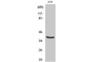Western Blotting (WB) image for anti-Vimentin (VIM) (Tyr321) antibody (ABIN3187474) (Vimentin 抗体  (Tyr321))