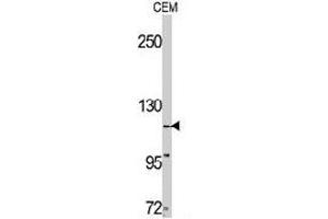 Western blot analysis of TNK2 polyclonal antibody  in CEM cell line lysates (35 ug/lane). (TNK2 抗体  (C-Term))