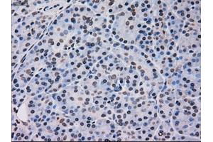 Immunohistochemical staining of paraffin-embedded pancreas tissue using anti-MAPK12mouse monoclonal antibody. (MAPK12 抗体)