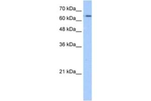 Western Blotting (WB) image for anti-Solute Carrier Family 22 (Organic Cation Transporter), Member 11 (SLC22A11) antibody (ABIN2462761) (SLC22A11 抗体)