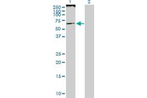 Western Blot analysis of SMARCE1 expression in transfected 293T cell line by SMARCE1 MaxPab polyclonal antibody. (SMARCE1 抗体  (AA 1-411))