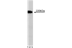 Western Blotting (WB) image for anti-Tight Junction Protein 1 (TJP1) (AA 1048-1247) antibody (ABIN968283) (TJP1 抗体  (AA 1048-1247))