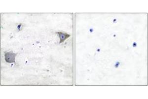 Immunohistochemistry (IHC) image for anti-Platelet Derived Growth Factor Receptor alpha (PDGFRA) (AA 1031-1080) antibody (ABIN2889249) (PDGFRA 抗体  (AA 1031-1080))