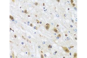 Immunohistochemistry of paraffin-embedded Rat brain using HDAC4 Polyclonal Antibody at dilution of 1:100 (40x lens). (HDAC4 抗体)
