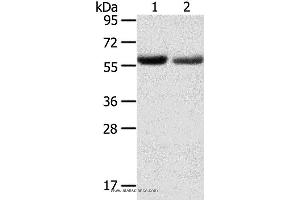 Western blot analysis of Human normal stomach and stomach cancer tissue, using SLC16A9 Polyclonal Antibody at dilution of 1:200 (SLC16A9 抗体)