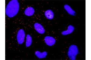 Proximity Ligation Analysis of protein-protein interactions between ARRB2 and CTNNA1. (CTNNA1 抗体  (AA 152-250))