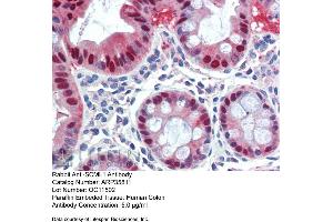 Immunohistochemistry with Human Colon lysate tissue at an antibody concentration of 5. (SCML1 抗体  (Middle Region))