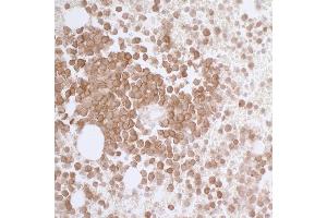 Immunohistochemistry (IHC) image for anti-CD33 (CD33) (AA 314-364) antibody (ABIN7453876) (Recombinant CD33 抗体  (AA 314-364))