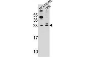 IFI6 Antibody (N-term) western blot analysis in MDA-MB453,CEM cell line lysates (35µg/lane). (IFI6 抗体  (N-Term))