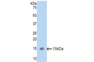 Detection of Recombinant SPC, Mouse using Polyclonal Antibody to Surfactant Protein C (SP-C)