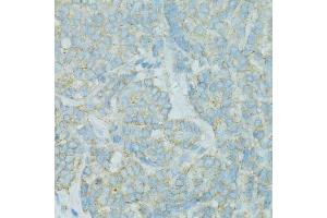 Immunohistochemistry (Paraffin-embedded Sections) (IHC (p)) image for anti-Tight Junction Protein 2 (Zona Occludens 2) (TJP2) (AA 951-1190) antibody (ABIN1683322)