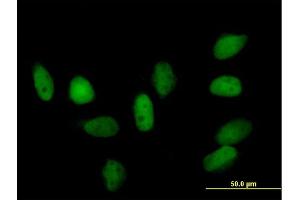 Immunofluorescence of purified MaxPab rabbit antibody to CBX5 on HeLa cell. (CBX5 抗体  (AA 1-191))