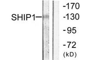 Western blot analysis of extracts from mouse brain cells, using SHIP1 (Ab-1020) Antibody. (INPP5D 抗体  (AA 987-1036))