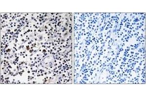 Immunohistochemistry analysis of paraffin-embedded human lymph node tissue, using CD302 Antibody. (DCL1 抗体  (AA 51-100))
